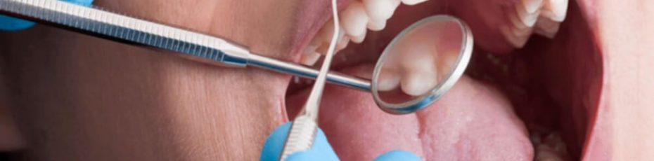 root canal therapy can change your life