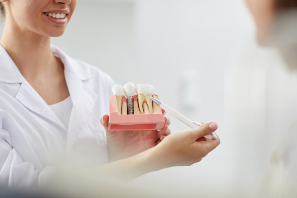 the long-term benefits of dental implants
