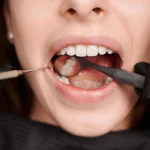 dental crowns pain recovery aftercare