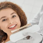 porcelain veneers maintenance guide