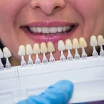 dental crown falls off emergency guide